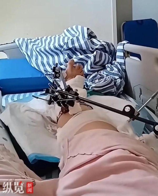 爱配配资 女子从12楼不慎坠落奇迹生还 车棚成救命缓冲